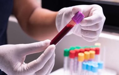 Який рівень лейкоцитів у крові у дітей та дорослих – нормальний
