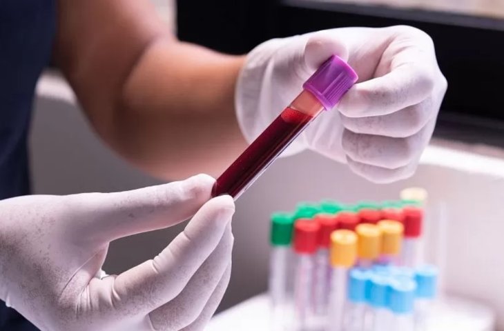 Який рівень лейкоцитів у крові у дітей та дорослих – нормальний