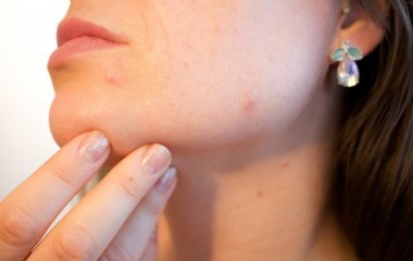9 симптомів, які можуть говорити про передозування парацетомолом