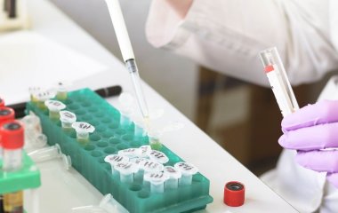 В одній з країн вікрали з лабораторії 300 флаконів з небезпечними вірусами: чи є загроза для України