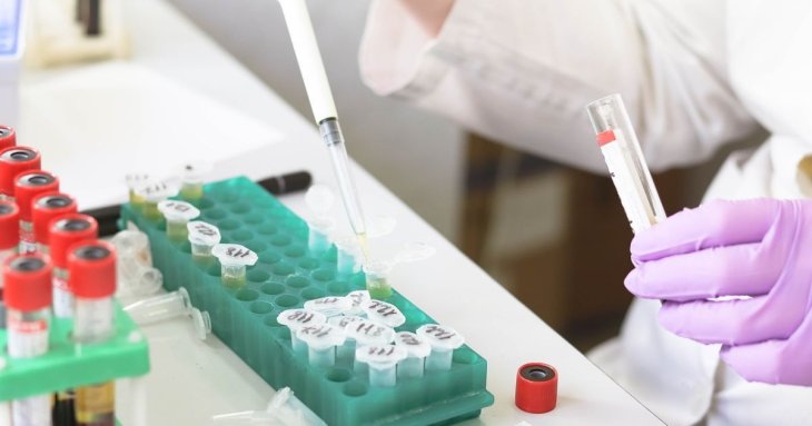 В одній з країн вікрали з лабораторії 300 флаконів з небезпечними вірусами: чи є загроза для України