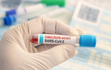 Вчені оцінили вплив омікрон-штаму на легені