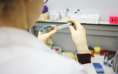 Знайдені білки, що впливають на тривалість життя