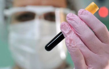 Терапевт пояснив, навіщо вам багато 