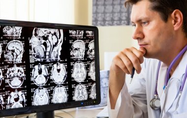 Слабоумство: 7 найбільш «типових ранніх симптомів» хвороби Альцгеймера