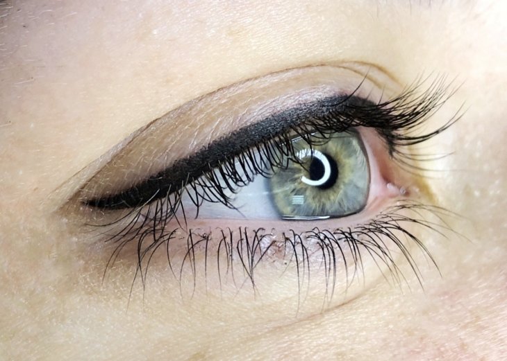 Медики рассказали, на какие заболевания указывает выпадение ресниц