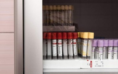 Кардіолог назвав спосіб знизити вкрай високий рівень холестерину