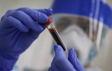 Вчені з'ясували, що зберігається імунітет до коронавірусу