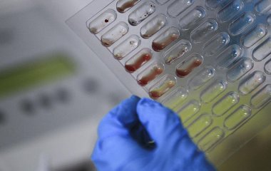 Вчені розповіли, чому не можна насильно їсти під час грипу