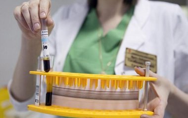 Онколог назвав сім симптомів розвитку раку