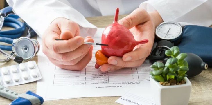 Онкоуролог закликав прибрати з раціону три продукти: Жир із канцерогенами