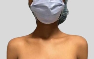 Перший випадок: груди 19-річної жінки втричі збільшилися після вакцинації від COVID – фото