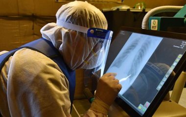 Инфекционист заявил о возможности поражения любого органа при COVID-19