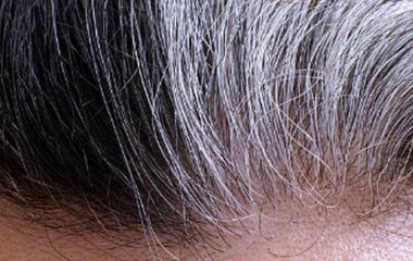 Як уникнути ранньої сивини та які хвороби її викликають? Пояснює трихолог