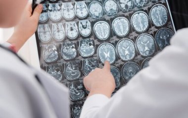 Онколог назвав перший симптом раку: Виявляється під час їжі