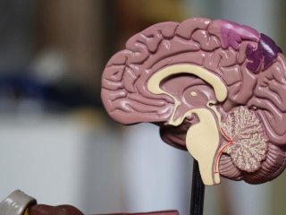 Ученые доказали обратимость смерти мозга