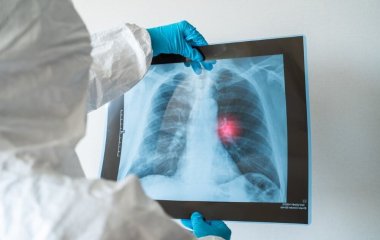 Протікає без симптомів інфекція COVID-19 все одно викликає ураження легень