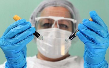 Як у домашніх умовах позбутися загущення крові після коронавірусу