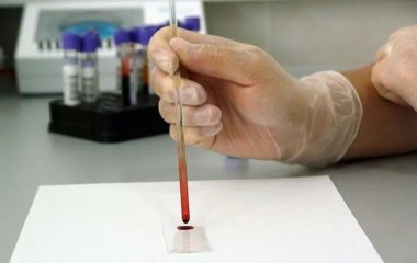 Що треба з'їсти, щоб швидко підняти гемоглобін