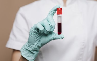 Які повсякденні звички провокують біль у суглобах