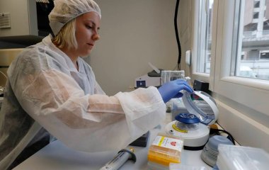 У білка з печінки знайшли здатність омолоджувати мозок подібно до занять спортом.