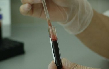 Як визначити ризик інфаркту за звичайним аналізом крові