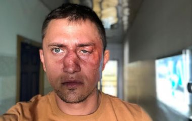 В каких условиях проходит лечение Павел Прилучный