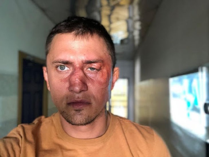 В каких условиях проходит лечение Павел Прилучный