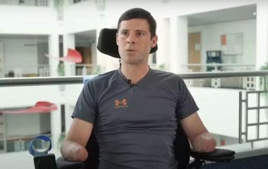 Чоловікові ампутували всі кінцівки після надування матраца: що сталося (фото)