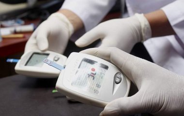 Медики назвали незвичайний симптом підвищеного холестерину