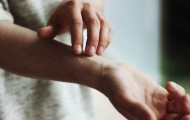 Хірург розповів про зв'язок між ожирінням та захворюваннями вен