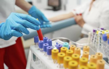 Названі способи визначення раку щодо змін на мові, яснах та щоках