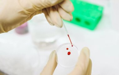 Про що може розповісти аналіз крові: 3 важливі показники, на які необхідно звернути увагу