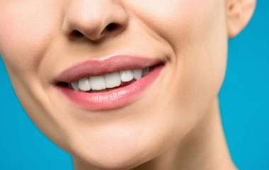 Как самостоятельно отбелить зубы: проверенные способы