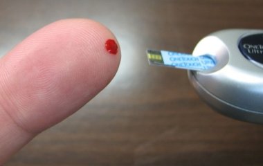 Чотири симптоми діабету 2 типу можуть здатися незвичайними