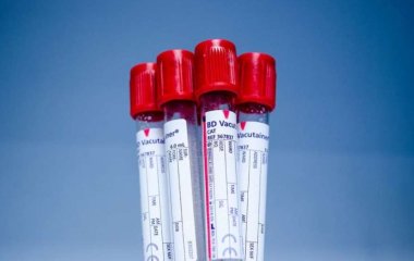 Медики выяснили, у людей с какой группой крови на 82% выше риск слабоумия