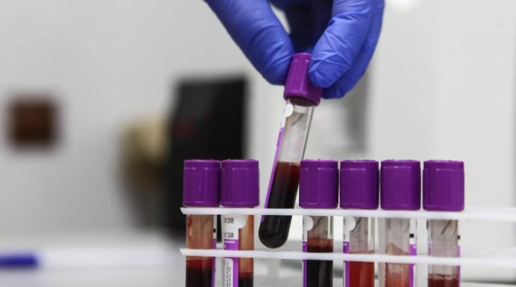 Онколог розповів, як гарячий душ допомагає виявити рак крові.