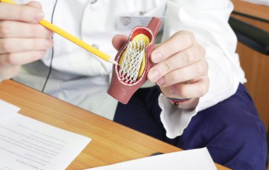 Пять симптомов, указывающих на то, что ваши артерии страдают от жира и холестерина