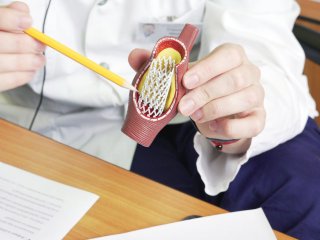 Пять симптомов, указывающих на то, что ваши артерии страдают от жира и холестерина