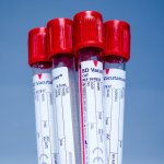 Ученые определили, люди с какой группой крови живут дольше