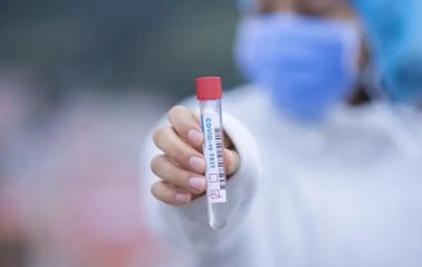 МОЗ оновило стандарти допомоги пацієнтам із коронавірусом. Щепленим не знадобиться самоізоляція