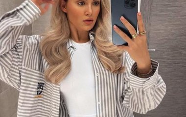 Инстамодель показала, как выглядят ее настоящие зубы после удаления виниров