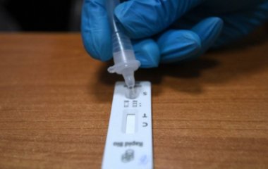 Імунолог дала пораду, коли і як проводити самотестування на COVID-19