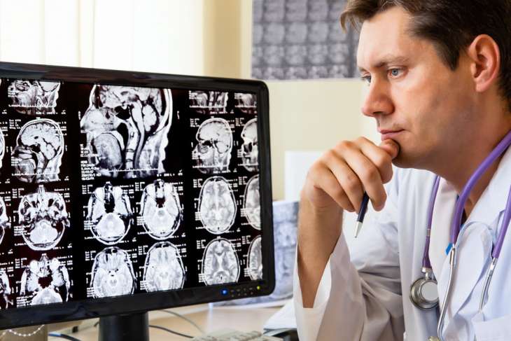 Слабоумие: 7 наиболее «типичных ранних симптомов» болезни Альцгеймера