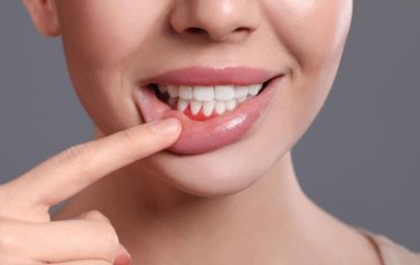 Не пропустіть сигнал. Які проблеми з яснами виникають після 30 років