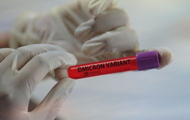 Вчені пояснили принцип проникнення омікрону до клітин людини